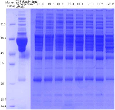 DIA-based technology explores hub pathways and biomarkers of neurological recovery in ischemic stroke after rehabilitation